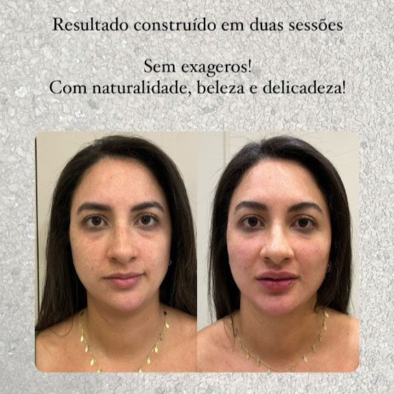 Antes e Depois 1